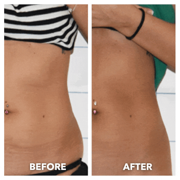 Nami Cares™ Pro Body Ultrasonic Fat & Cellulite Burner